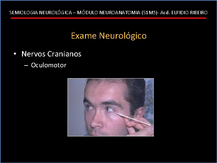 SEMIOLOGIA NEUROLÓGICA – MÓDULO NEUROANATOMIA (S 1 M 5)- Acd. ELPIDIO RIBEIRO Exame Neurológico