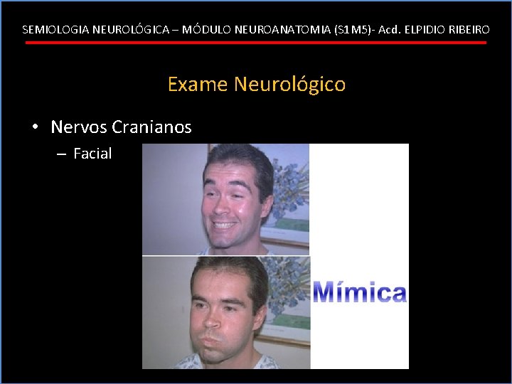 SEMIOLOGIA NEUROLÓGICA – MÓDULO NEUROANATOMIA (S 1 M 5)- Acd. ELPIDIO RIBEIRO Exame Neurológico