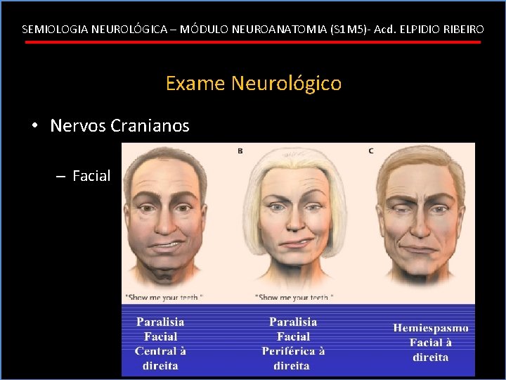 SEMIOLOGIA NEUROLÓGICA – MÓDULO NEUROANATOMIA (S 1 M 5)- Acd. ELPIDIO RIBEIRO Exame Neurológico