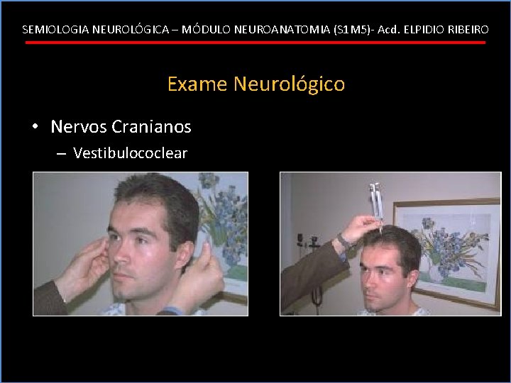 SEMIOLOGIA NEUROLÓGICA – MÓDULO NEUROANATOMIA (S 1 M 5)- Acd. ELPIDIO RIBEIRO Exame Neurológico