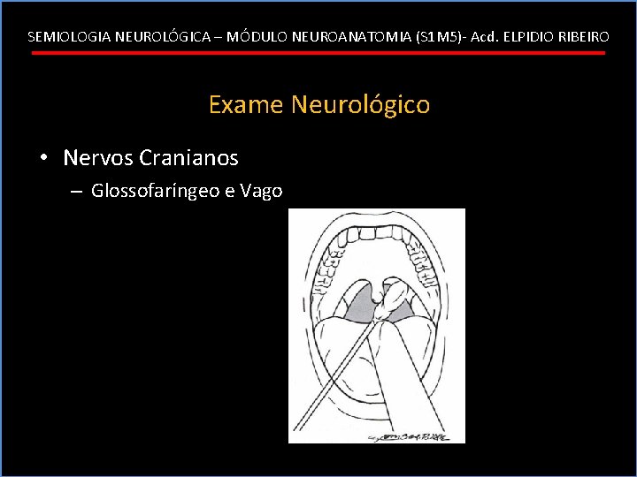 SEMIOLOGIA NEUROLÓGICA – MÓDULO NEUROANATOMIA (S 1 M 5)- Acd. ELPIDIO RIBEIRO Exame Neurológico