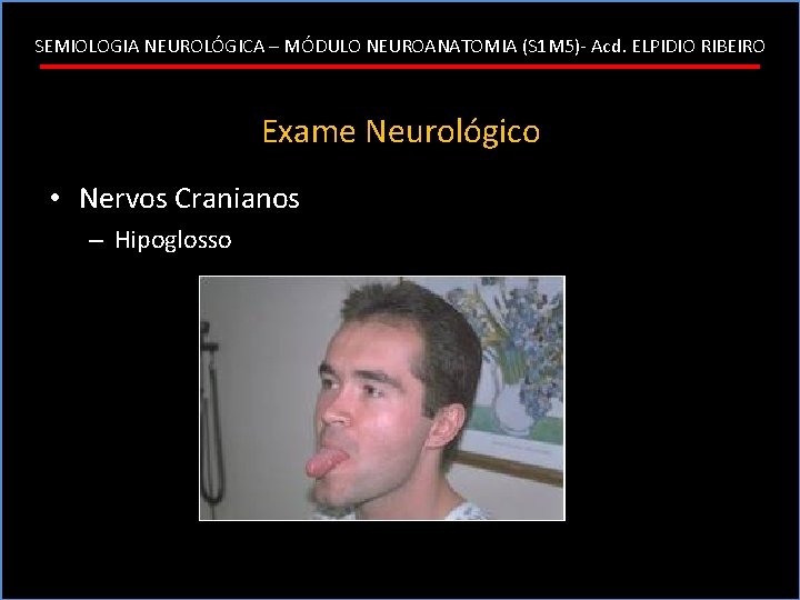 SEMIOLOGIA NEUROLÓGICA – MÓDULO NEUROANATOMIA (S 1 M 5)- Acd. ELPIDIO RIBEIRO Exame Neurológico