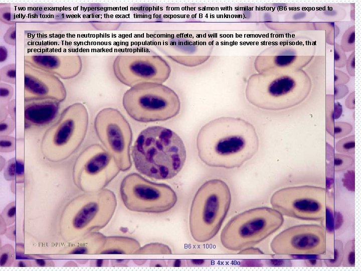 Two more examples of hypersegmented neutrophils from other salmon with similar history (B 6