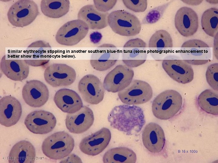 Similar erythrocyte stippling in another southern blue-fin tuna (some photographic enhancement to better show