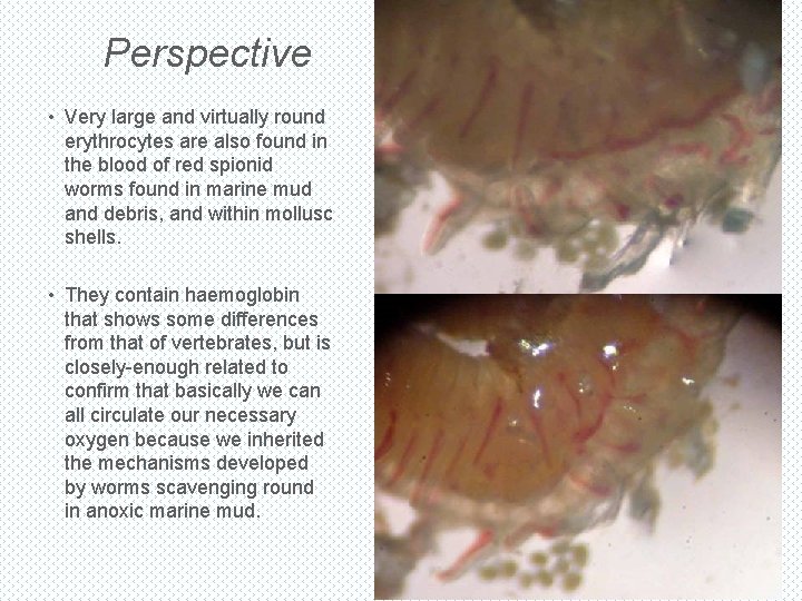 Perspective • Very large and virtually round erythrocytes are also found in the blood