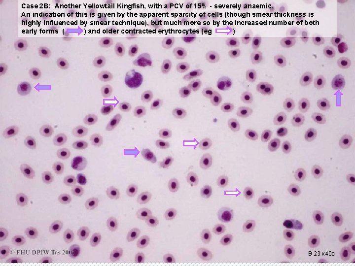 Case 2 B: Another Yellowtail Kingfish, with a PCV of 15% - severely anaemic.
