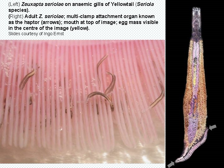 (Left) Zeuxapta seriolae on anaemic gills of Yellowtail (Seriola species). (Right) Adult Z. seriolae;