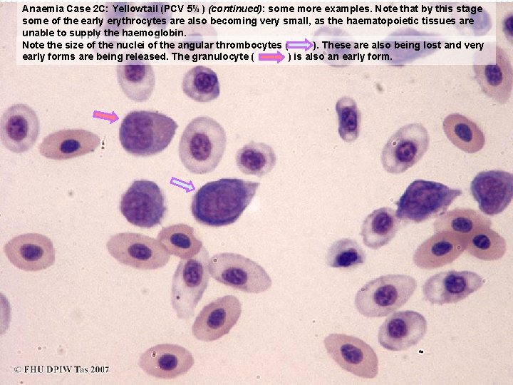 Anaemia Case 2 C: Yellowtail (PCV 5%) (continued): some more examples. Note that by