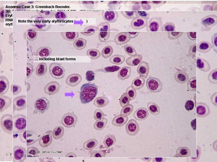 Anaemia Case 3: Greenback flounder. 3 B: Farmed juvenile flounder, PCV of 19%. (Oil