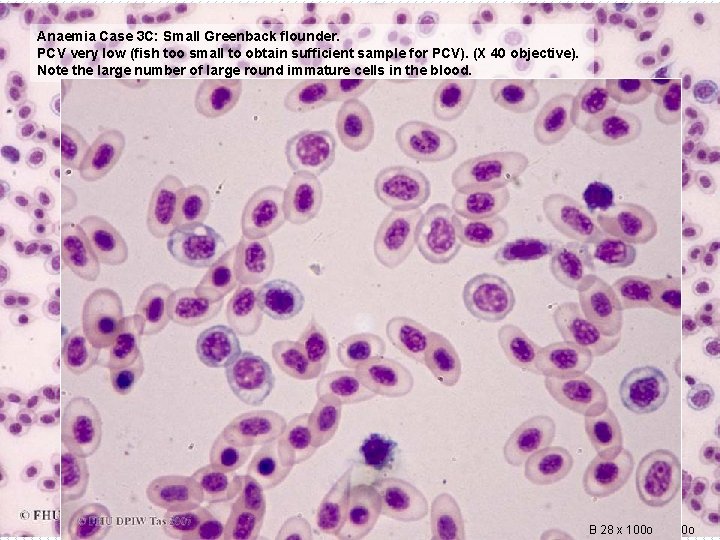 Anaemia Case 3 C: Small Greenback flounder. PCV very low (fish too small to