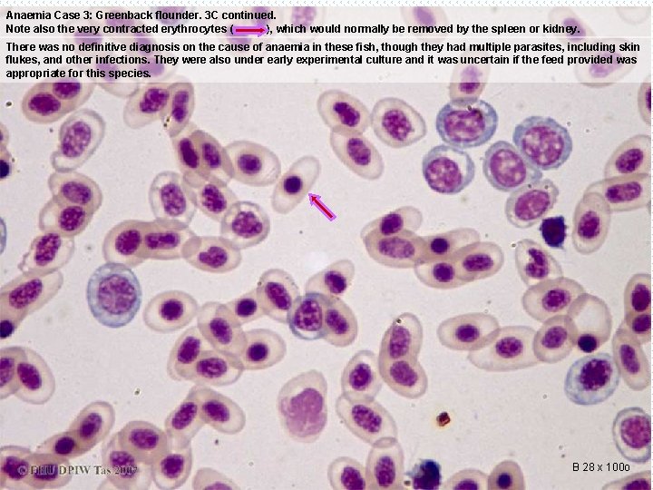 Anaemia Case 3: Greenback flounder. 3 C continued. Note also the very contracted erythrocytes