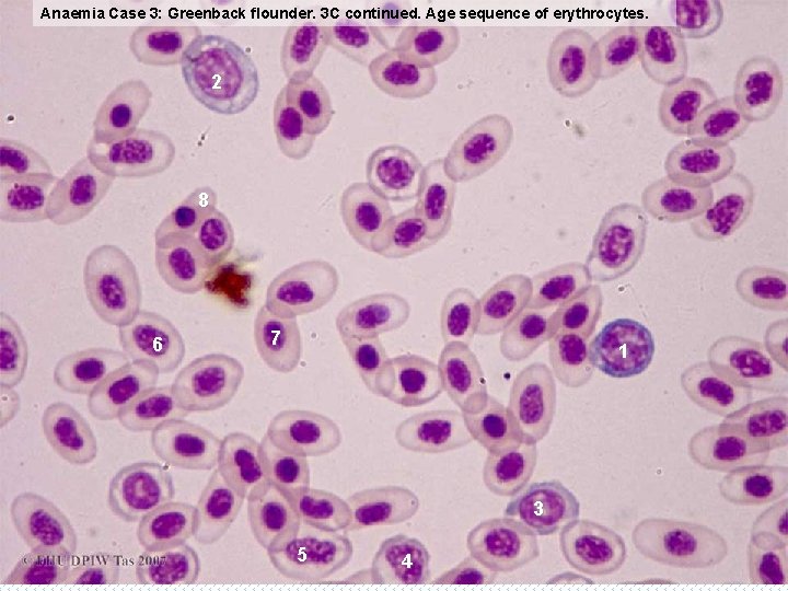 Anaemia Case 3: Greenback flounder. 3 C continued. Age sequence of erythrocytes. 2 8