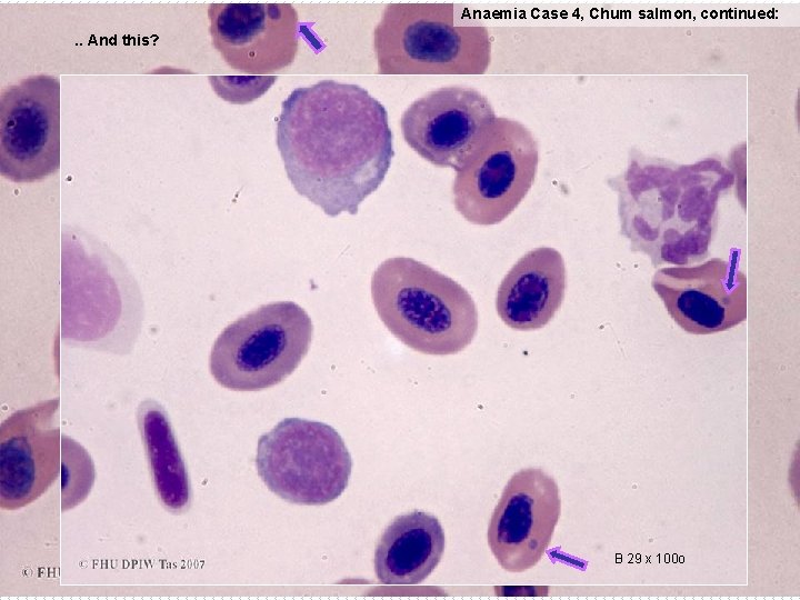 Anaemia Case 4, Chum salmon, continued: . . And this? B 29 x 100