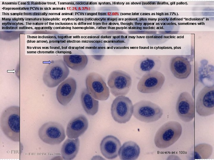 Anaemia Case 5: Rainbow trout, Tasmania, recirculation system. History as above (sudden deaths, gill