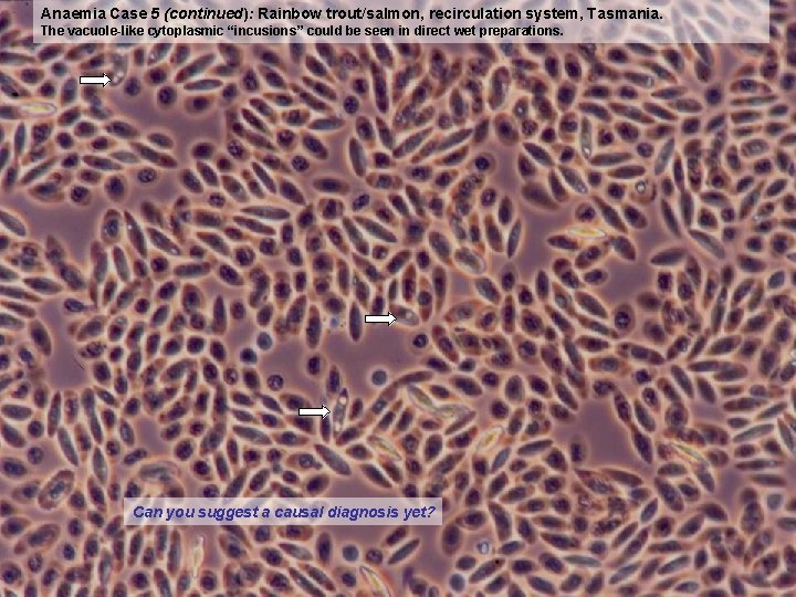 Anaemia Case 5 (continued): Rainbow trout/salmon, recirculation system, Tasmania. The vacuole-like cytoplasmic “incusions” could