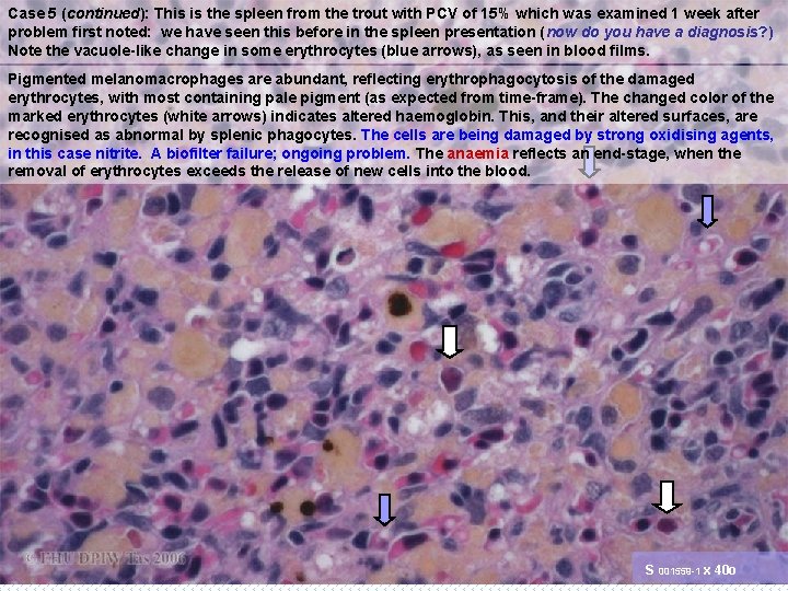 Case 5 (continued): This is the spleen from the trout with PCV of 15%