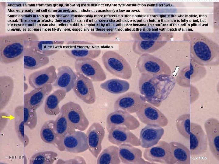 Another salmon from this group, showing more distinct erythrocyte vacuolation (white arrows). Also very