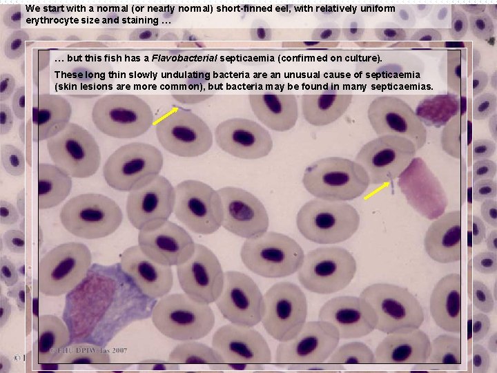 We start with a normal (or nearly normal) short-finned eel, with relatively uniform erythrocyte