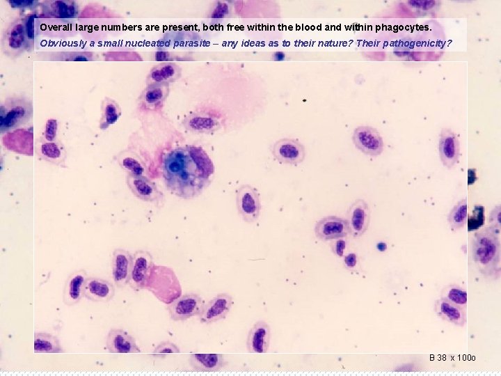 Overall large numbers are present, both free within the blood and within phagocytes. Obviously