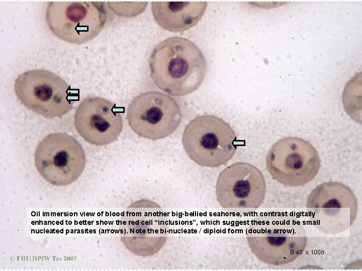Oil immersion view of blood from another big-bellied seahorse, with contrast digitally enhanced to