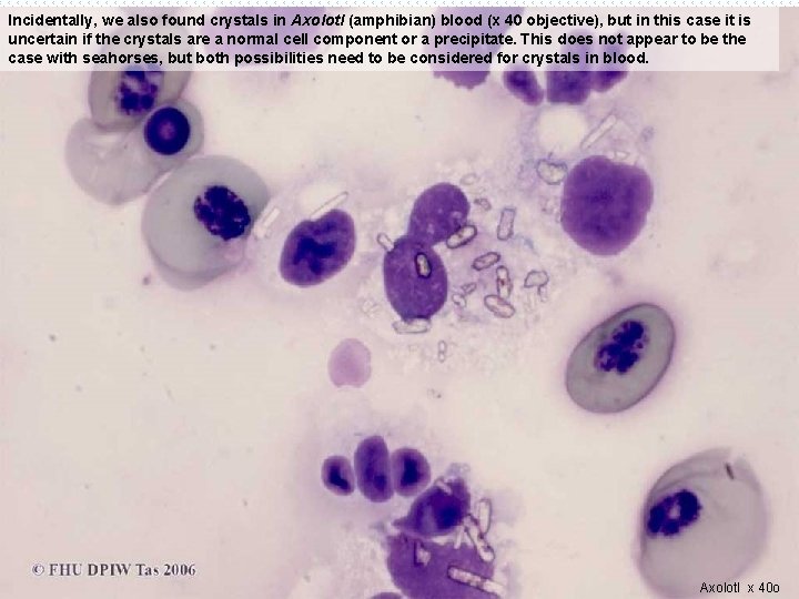 Incidentally, we also found crystals in Axolotl (amphibian) blood (x 40 objective), but in