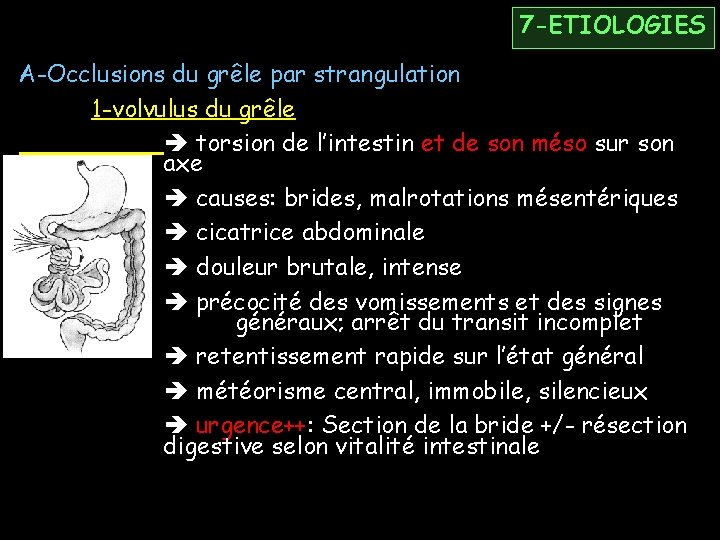 7 -ETIOLOGIES A-Occlusions du grêle par strangulation 1 -volvulus du grêle torsion de l’intestin