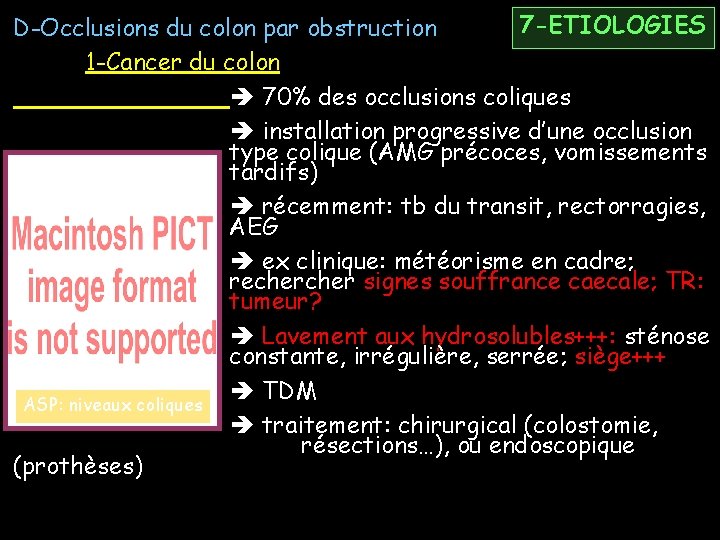 7 -ETIOLOGIES D-Occlusions du colon par obstruction 1 -Cancer du colon 70% des occlusions