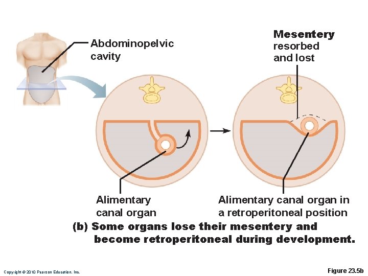 Abdominopelvic cavity Mesentery resorbed and lost Alimentary canal organ in canal organ a retroperitoneal