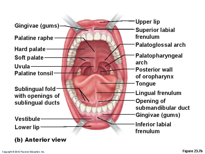 Gingivae (gums) Palatine raphe Hard palate Soft palate Uvula Palatine tonsil Sublingual fold with