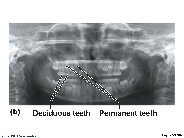 (b) Deciduous teeth Copyright © 2010 Pearson Education, Inc. Permanent teeth Figure 23. 10