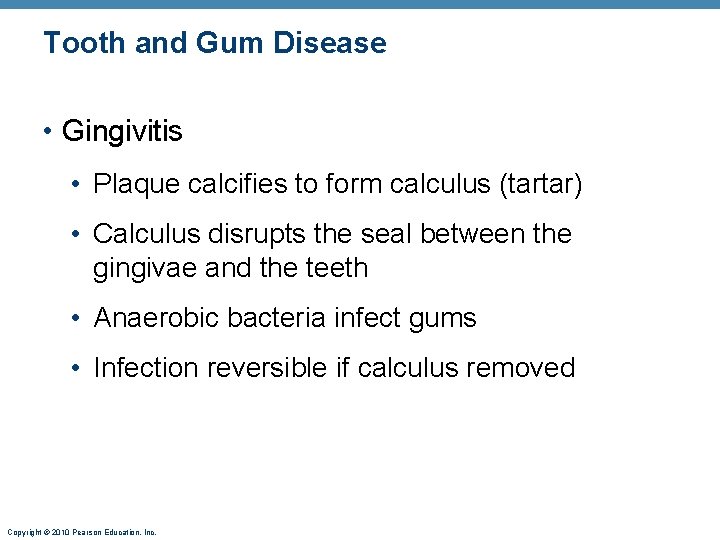 Tooth and Gum Disease • Gingivitis • Plaque calcifies to form calculus (tartar) •