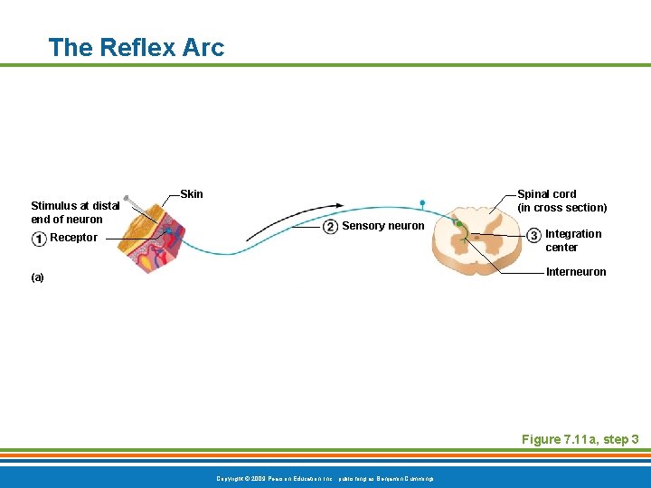 The Reflex Arc Skin Stimulus at distal end of neuron Receptor Spinal cord (in