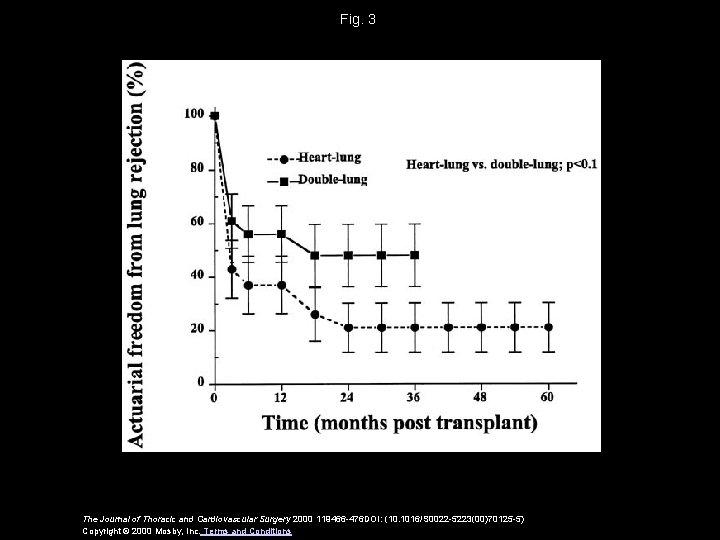Fig. 3 The Journal of Thoracic and Cardiovascular Surgery 2000 119466 -476 DOI: (10.