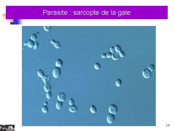 Parasite : sarcopte de la gale 14 