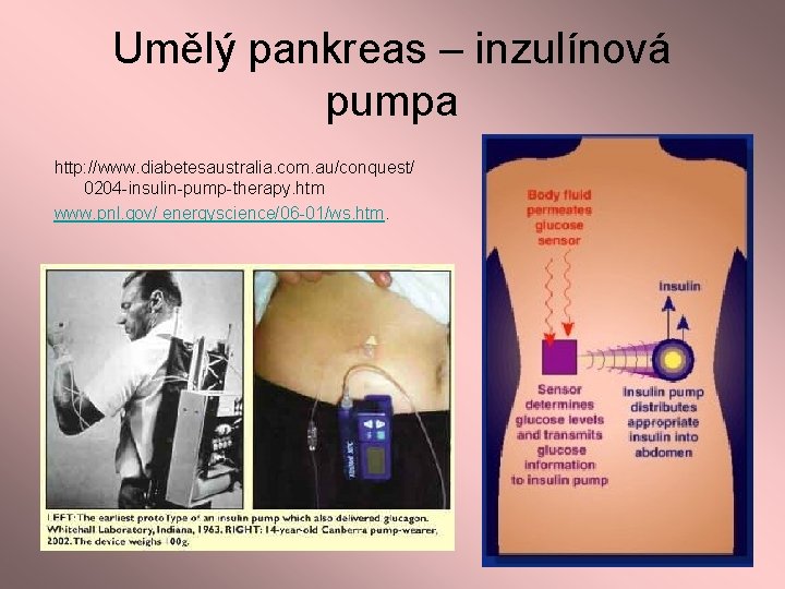 Umělý pankreas – inzulínová pumpa http: //www. diabetesaustralia. com. au/conquest/ 0204 -insulin-pump-therapy. htm www.