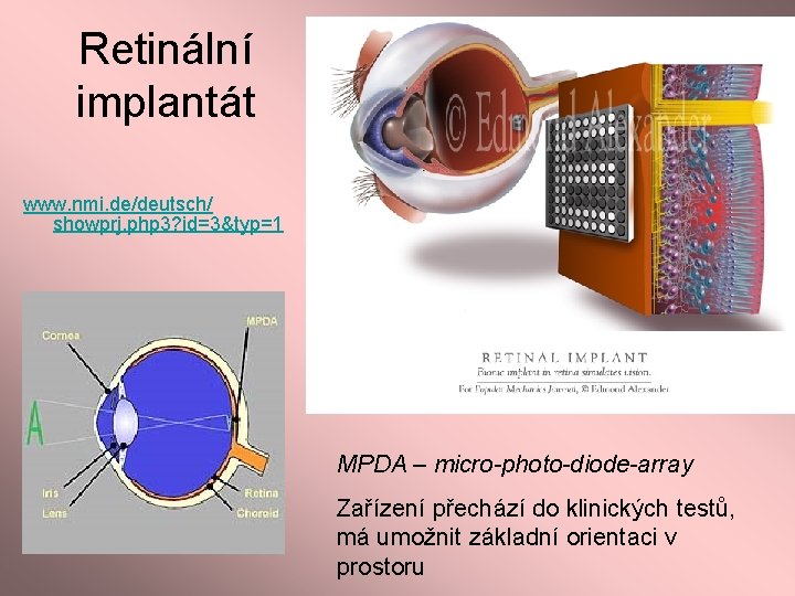 Retinální implantát www. nmi. de/deutsch/ showprj. php 3? id=3&typ=1 MPDA – micro-photo-diode-array Zařízení přechází