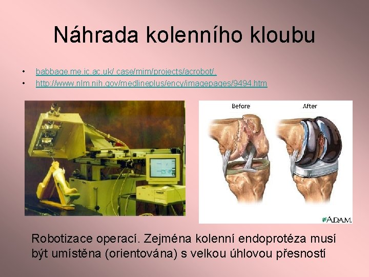 Náhrada kolenního kloubu • • babbage. me. ic. ac. uk/ case/mim/projects/acrobot/. http: //www. nlm.