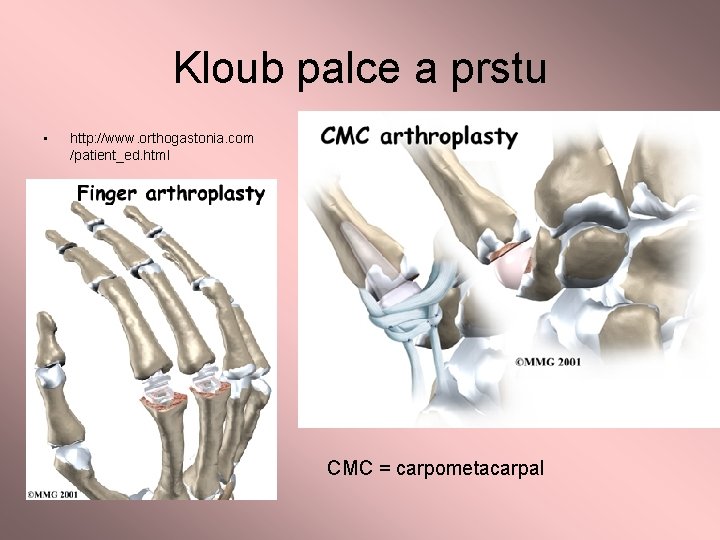Kloub palce a prstu • http: //www. orthogastonia. com /patient_ed. html CMC = carpometacarpal