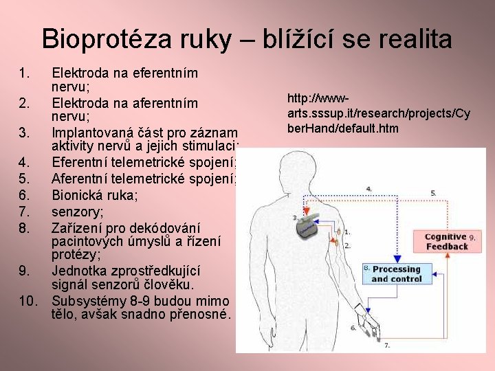 Bioprotéza ruky – blížící se realita 1. Elektroda na eferentním nervu; 2. Elektroda na