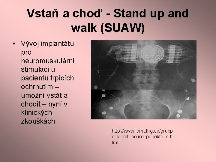 Vstaň a choď - Stand up and walk (SUAW) • Vývoj implantátu pro neuromuskulární