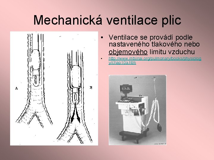 Mechanická ventilace plic • Ventilace se provádí podle nastaveného tlakového nebo objemového limitu vzduchu