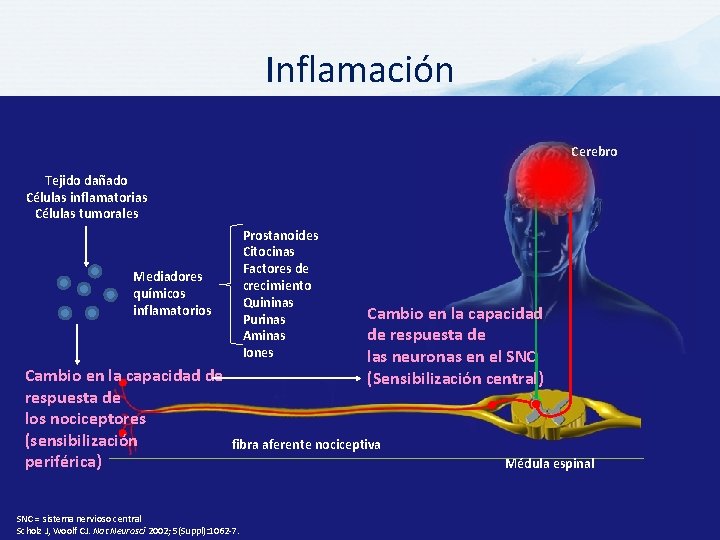 Inflamación Cerebro Tejido dañado Células inflamatorias Células tumorales Prostanoides Citocinas Factores de crecimiento Quininas