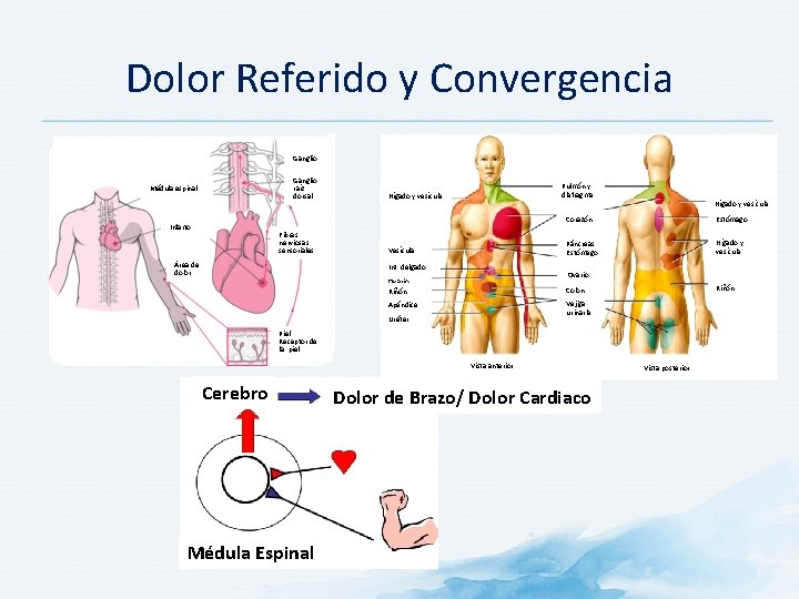 Dolor Referido y Convergencia Ganglio raíz dorsal Médula espinal Infarto Fibras nerviosas sensoriales Área