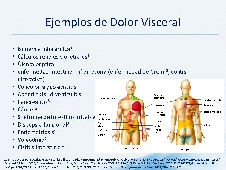 Ejemplos de Dolor Visceral • • • • Isquemia miocárdica 1 Cálculos renales y