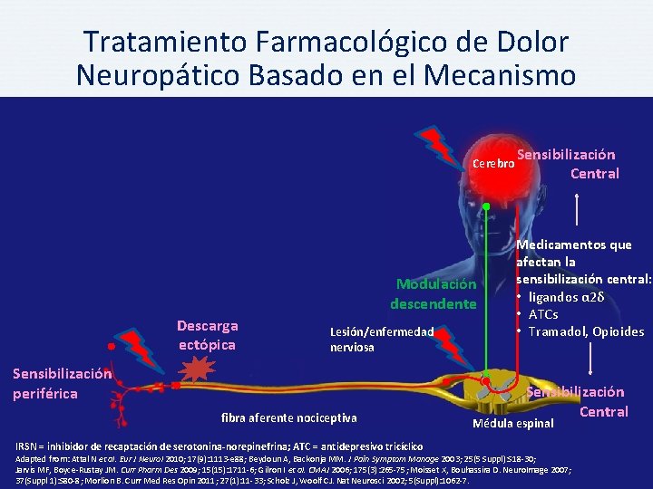 Tratamiento Farmacológico de Dolor Neuropático Basado en el Mecanismo Cerebro Modulación descendente Descarga ectópica
