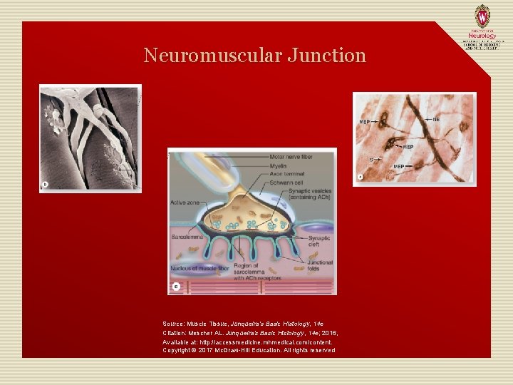 Neuromuscular Junction Source: Muscle Tissue, Junqueira's Basic Histology, 14 e Citation: Mescher AL. Junqueira's