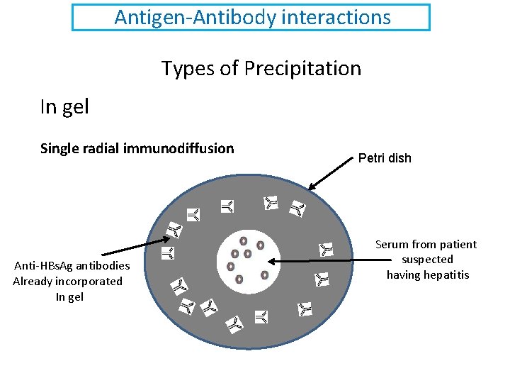 Antigen-Antibody interactions Types of Precipitation In gel Single radial immunodiffusion Anti-HBs. Ag antibodies Already