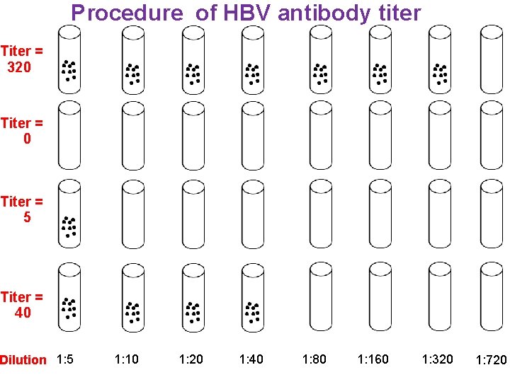 Procedure of HBV antibody titer Titer = 320 Titer = 5 Titer = 40