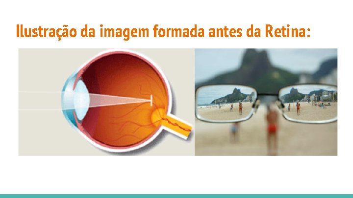 Ilustração da imagem formada antes da Retina: 