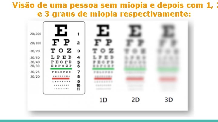 Visão de uma pessoa sem miopia e depois com 1, 2 e 3 graus